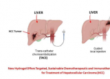 药物洗脱水凝胶增强肝癌治疗