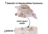 科学家发现基因疗法可降低动物模型中的肝癌