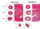 RNA结合蛋白IGF2BP2被确定为应激性扩张型心肌病的关键参与者