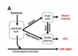 阿尔茨海默病研究人员将淀粉样蛋白降解毒性假说扩展到人群水平