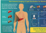 研究揭示了机器学习辅助的非侵入性成像技术 可实现肝脏脂肪的快速可视化