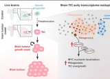 研究为脑肿瘤发展的最早阶段提供了新的见解