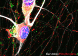 研究发现 mRNA 与溶酶体囊泡一起转运至轴突可防止轴突变性