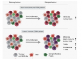 研究确定了胶质母细胞瘤免疫治疗耐药性的机制