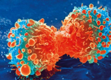 研究人员称肿瘤浸润淋巴细胞疗法标志着癌症治疗的一个里程碑