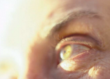 18 项测量方法可靠地评估青光眼症状负担