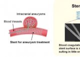 科学家创造新型抗血栓涂层以克服血管内治疗的挑战