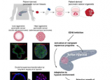 类器官研究发现胰腺癌在转变为侵袭性类型时会改变身份